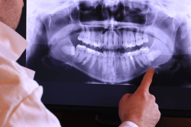 Best Emergency TMJ Treatment in Durham, NC