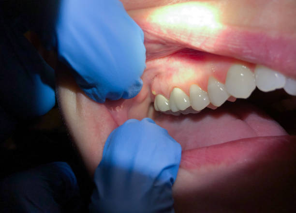 Best Cosmetic Emergency Dentistry in Durham, NC