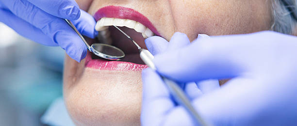 Best Emergency Denture Repair in Durham, NC
